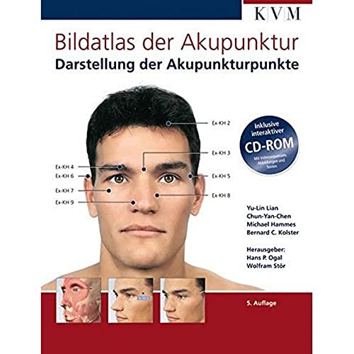 Stock image for Bildatlas der Akupunktur: Darstellung der Akupunkturpunkte (inkl. interaktiver CD-ROM) for sale by medimops