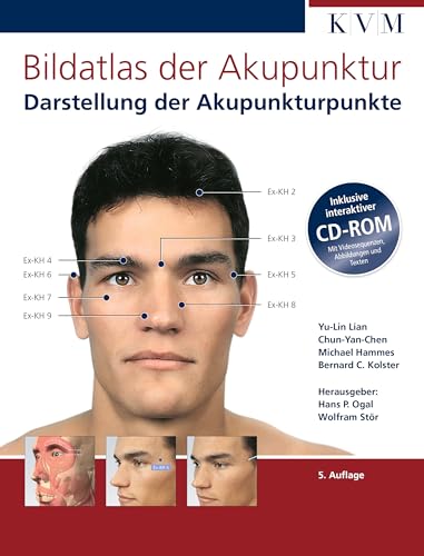 Stock image for Bildatlas der Akupunktur: Darstellung der Akupunkturpunkte (inkl. interaktiver CD-ROM) for sale by medimops