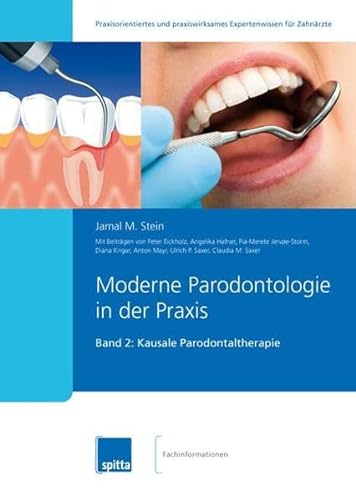 Beispielbild fr Moderne Parodontologie in der Praxis 02: Kausale Parodontaltherapie zum Verkauf von medimops