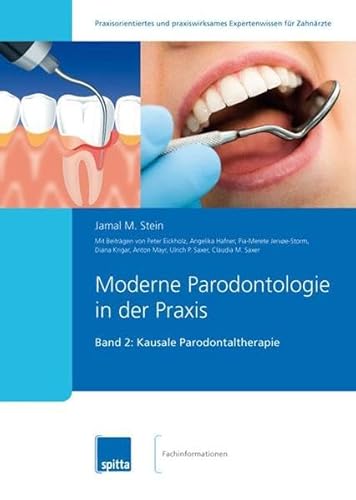 Stock image for Moderne Parodontologie in der Praxis 02: Kausale Parodontaltherapie for sale by medimops