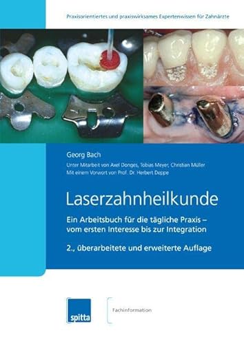 9783943996470: Laserzahnheilkunde: Ein Arbeitsbuch fr die tgliche Praxis - vom ersten Interesse bis zur Integration