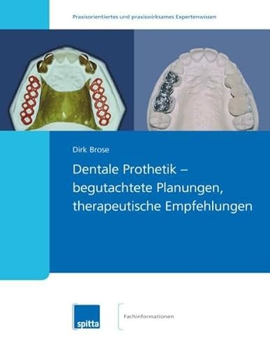 9783943996722: Dentale Prothetik - begutachtete Planungen, therapeutische Empfehlungen