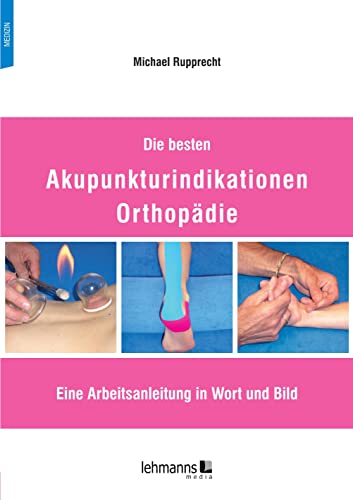 9783965434127: Die besten Akupunkturindikationen Orthopdie: Eine Arbeitsanleitung in Wort und Bild