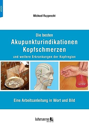9783965434196: Die besten Akupunkturindikationen Kopfschmerzen und weitere Erkrankungen der Kopfregion: Eine Arbeitsanleitung in Wort und Bild