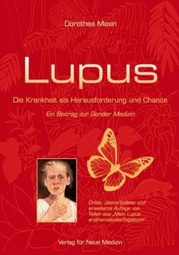 Beispielbild fr Lupus: Die Krankheit als Herausforderung und Chance. Ein Beitrag zur Gender Medizin Maxin, Dorothea zum Verkauf von online-buch-de