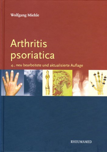 Beispielbild fr Arthritis psoriatika zum Verkauf von medimops