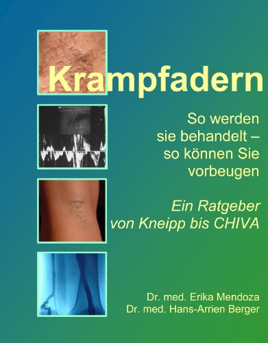 Stock image for Krampfadern: So werden sie behandelt - so knnen Sie vorbeugen. Ein Ratgeber von Kneipp bis CHIVA for sale by medimops