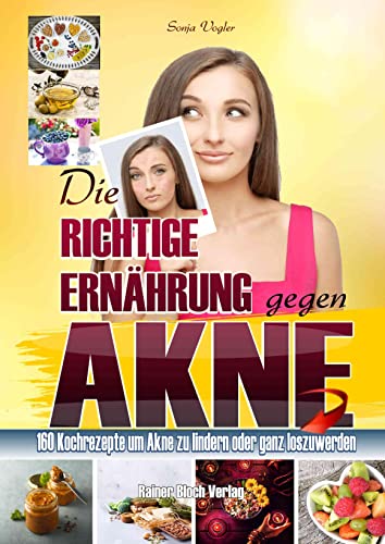 Stock image for Die richtige Ernhrung gegen Akne -Language: german for sale by GreatBookPrices