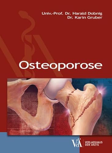 9783990521311: Osteoporose
