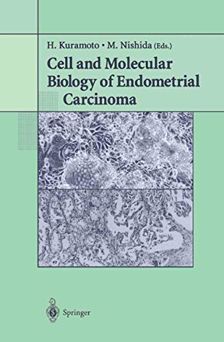 Cell And Molecular Biology Of Endometrial Carcinoma