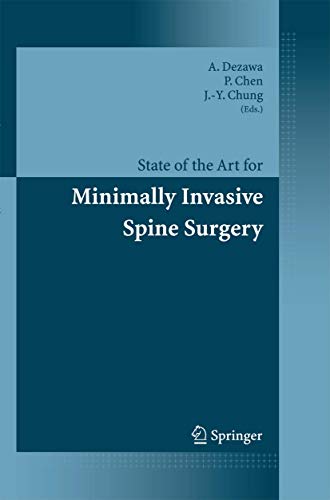 9784431012481: State Of The Art For Minimally Invasive Spine Surgery
