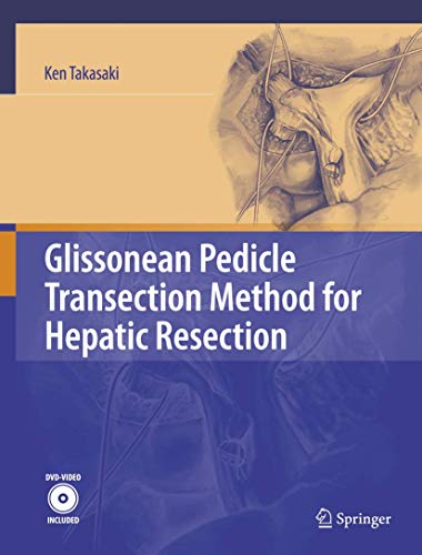 9784431489436: Glissonean Pedicle Transection Method for Hepatic Resection: Simplified Procedure of Systematized Hepatic Resection