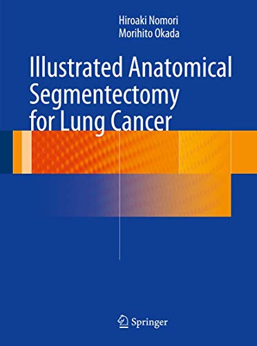 9784431541431: Illustrated Anatomical Segmentectomy for Lung Cancer