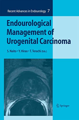 9784431546559: Endourological Management of Urogenital Carcinoma: 7