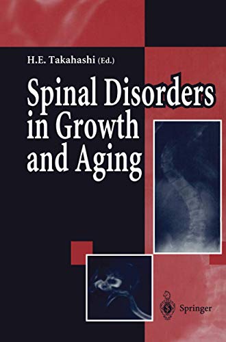 9784431669418: Spinal Disorders in Growth and Aging