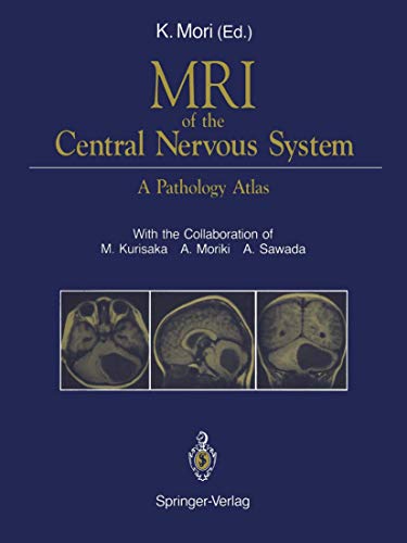 Stock image for MRI of the Central Nervous System: A Pathology Atlas for sale by Lucky's Textbooks