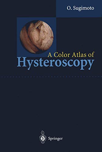 9784431683933: A Color Atlas of Hysteroscopy