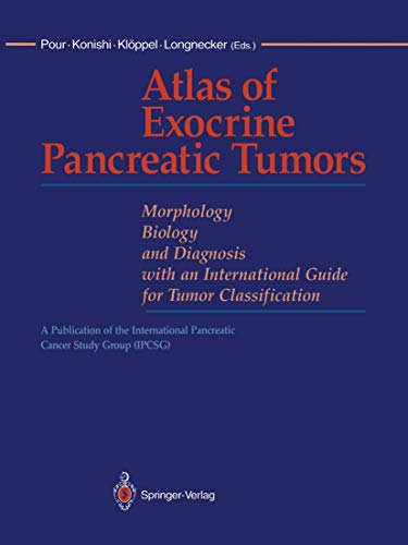 Stock image for Atlas of Exocrine Pancreatic Tumors: Morphology, Biology, and Diagnosis with an International Guide for Tumor Classification for sale by dsmbooks