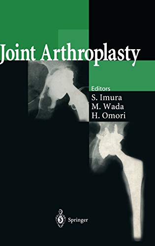 Imagen de archivo de Joint Arthroplasty a la venta por Zubal-Books, Since 1961