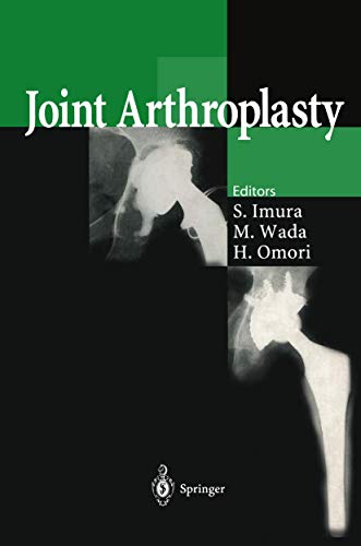 Stock image for Joint Arthroplasty for sale by Zubal-Books, Since 1961