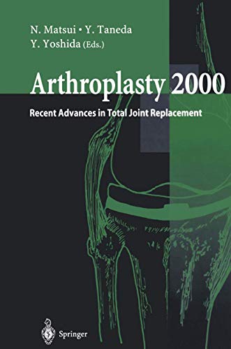 Arthroplasty 2000 - Recent Advances in Total Joint Replacement