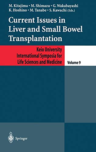 9784431703327: Current Issues in Liver and Small Bowel Transplantation