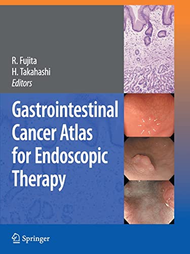 9784431998600: Gastrointestinal Cancer Atlas for Endoscopic Therapy