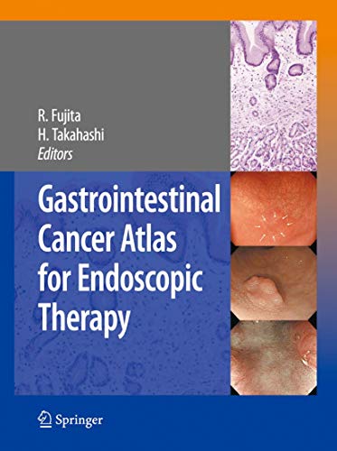 Gastrointestinal Cancer Atlas for Endoscopic Therapy [Paperback]