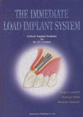 Beispielbild fr Immediate Head Implant System zum Verkauf von Books From California