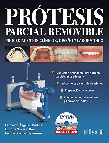 9786071702944: Protesis parcial removible / Removable Partial Denture: Procedimientos clinicos, diseno y laboratorio / Clinical Procedures, Laboratory and Design