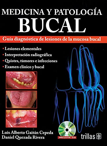 9786071722065: MEDICINA Y PATOLOGIA BUCAL. GUIA DIAGNOSTICA DE LESIONES DE LA MUCOSA BUCAL (INCLUYE CD)