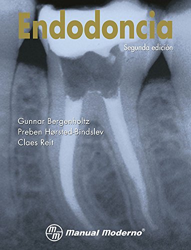 Imagen de archivo de Endodoncia Gunnar Bergenholtz a la venta por Iridium_Books