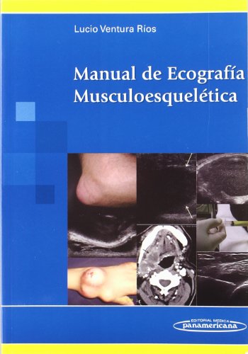 Imagen de archivo de MANUAL DE ECOGRAFIA MUSCULOESQUELETICVENTURA RIOS, LUCIO a la venta por Iridium_Books