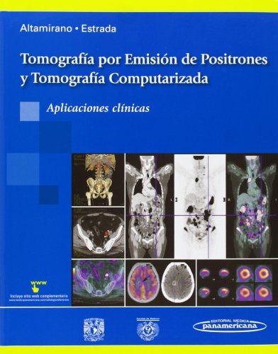9786077743996: Tomografa por Emisin de Positrones y Tomografa Computarizada (Spanish Edition)