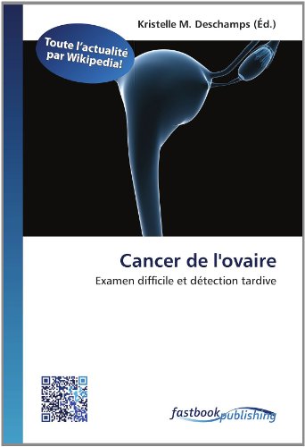 9786130120283: Cancer de l'ovaire: Examen difficile et dtection tardive (French Edition)