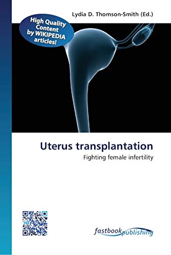 Imagen de archivo de Uterus transplantation a la venta por Lucky's Textbooks