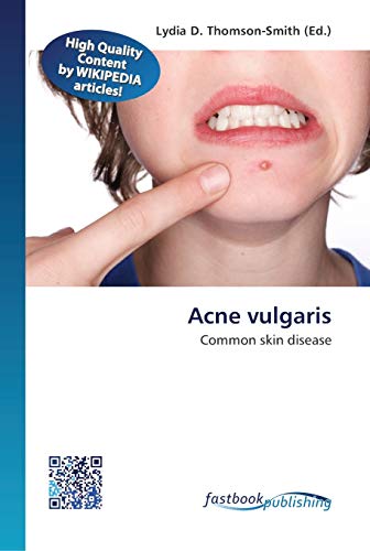Stock image for Acne vulgaris for sale by Lucky's Textbooks