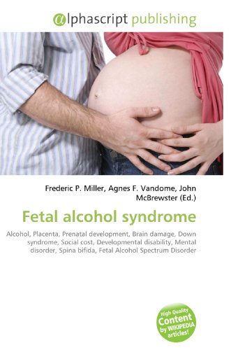 Fetal alcohol syndrome - Frederic P Miller