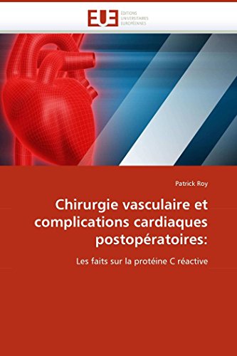 9786131504891: Chirurgie vasculaire et complications cardiaques postopratoires: Les faits sur la protine C ractive (OMN.UNIV.EUROP.)