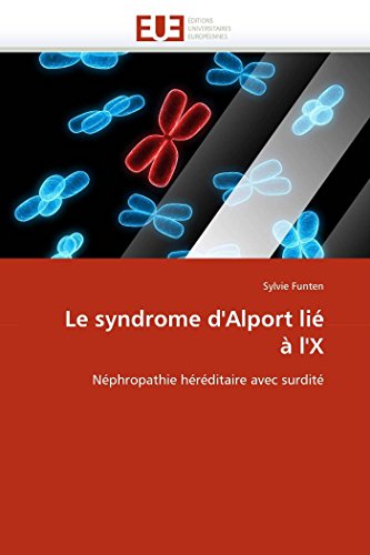 9786131570797: Le syndrome d'Alport li  l'X: Nphropathie hrditaire avec surdit (Omn.Univ.Europ.) (French Edition)