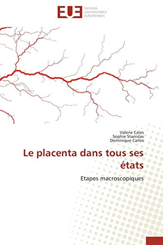 Imagen de archivo de Le placenta dans tous ses tats: Etapes macroscopiques (Omn.Univ.Europ.) (French Edition) a la venta por Lucky's Textbooks