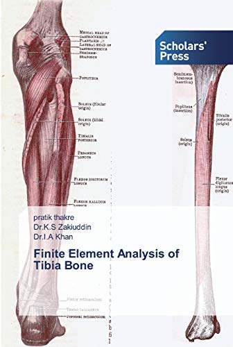 Stock image for Finite Element Analysis of Tibia Bone for sale by Lucky's Textbooks
