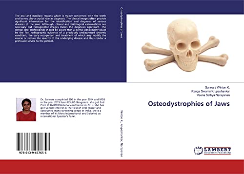 Stock image for Osteodystrophies of Jaws for sale by Buchpark