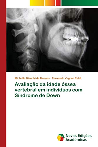 Stock image for Avaliao da idade ssea vertebral em indivduos com Sndrome de Down (Portuguese Edition) for sale by Lucky's Textbooks