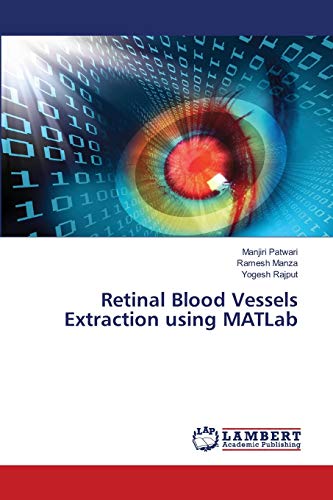 Beispielbild fr Retinal Blood Vessels Extraction using MATLab zum Verkauf von Lucky's Textbooks