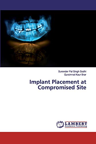 Stock image for Implant Placement at Compromised Site for sale by Lucky's Textbooks