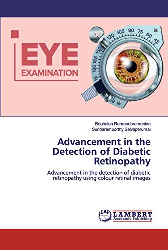 Stock image for Advancement in the Detection of Diabetic Retinopathy: Advancement in the detection of diabetic retinopathy using colour retinal images for sale by Lucky's Textbooks