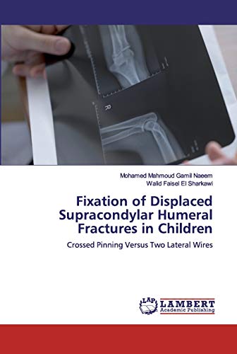 Stock image for Fixation of Displaced Supracondylar Humeral Fractures in Children: Crossed Pinning Versus Two Lateral Wires for sale by Lucky's Textbooks