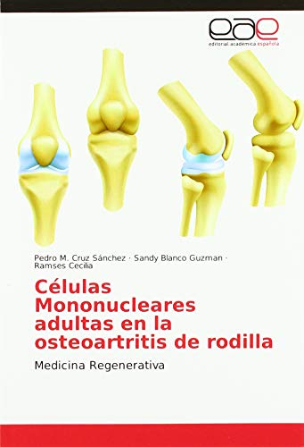 9786202155731: Clulas Mononucleares adultas en la osteoartritis de rodilla: Medicina Regenerativa