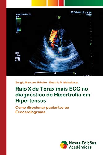 Stock image for Raio X de Trax mais ECG no diagnstico de Hipertrofia em Hipertensos (Portuguese Edition) for sale by Lucky's Textbooks